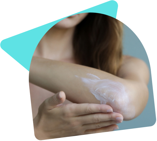 Dermatite atopique : comment prendre soin de sa peau ?